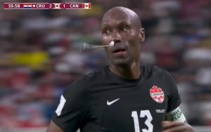 合乐世界杯运营：加拿大队长流鼻血直接塞棉条，创新用法引发热议
